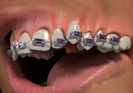 Orthodontics